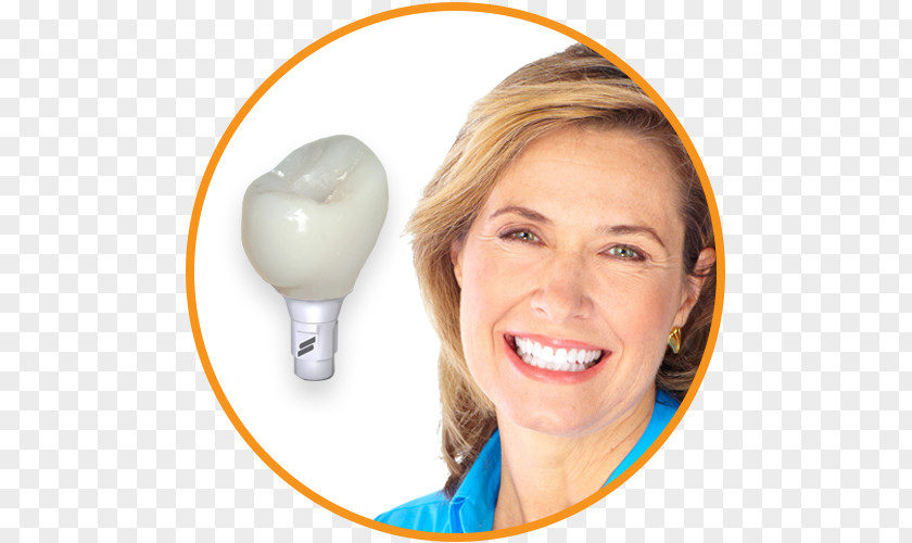 Implants Tooth Dental Implant Dentistry PNG