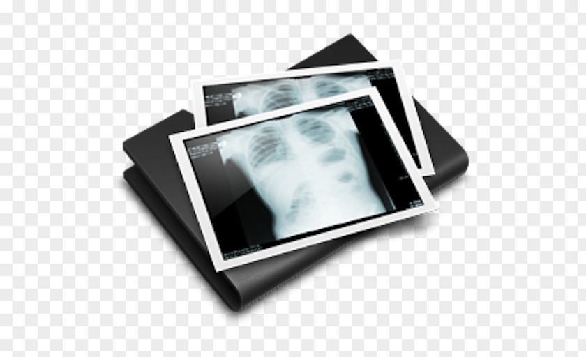 Xray Welding DICOM Digital Radiography Computer Software PNG