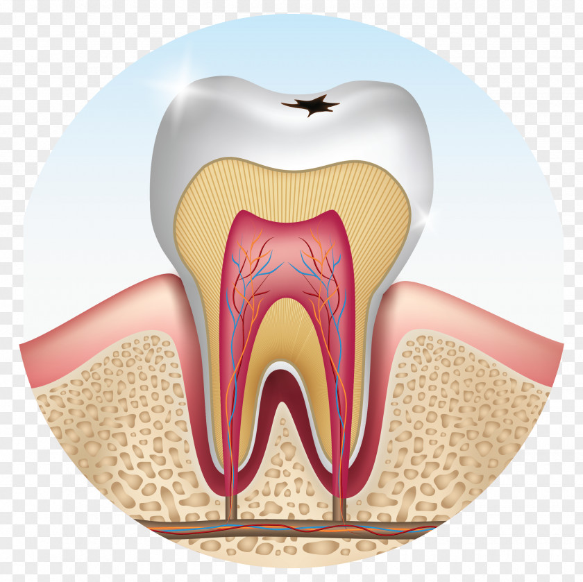 Tooth Human Wisdom Premolar Decay PNG