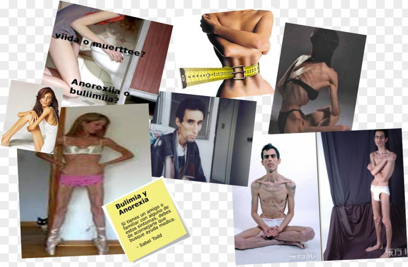 Collage Anorexia Nervosa Bulimia Disease Symptom PNG