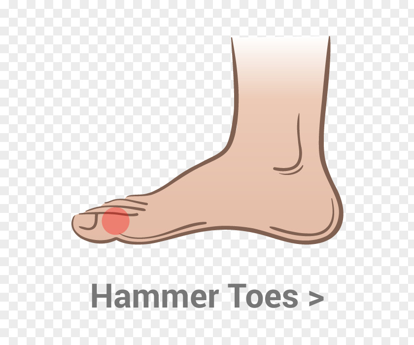 Ankle Pain Thumb Toe Shoe Bent Finger Ball PNG
