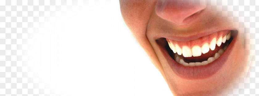 Tooth Surgery Smile Lip Cheek Mouth PNG