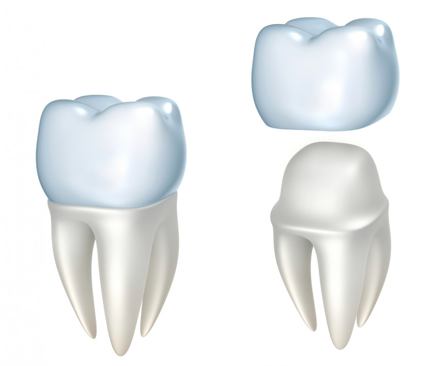 Teeth Crown Dentistry Dental Restoration Bridge PNG