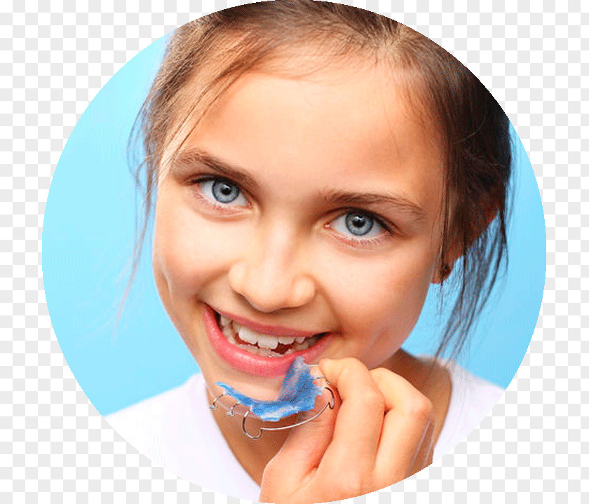 Child Orthodontics Dentistry Clear Aligners Retainer Dental Braces PNG