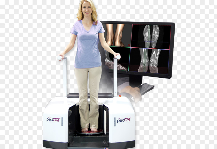 Navicular Syndrome Cone Beam Computed Tomography Weight-bearing Podiatrist X-ray PNG