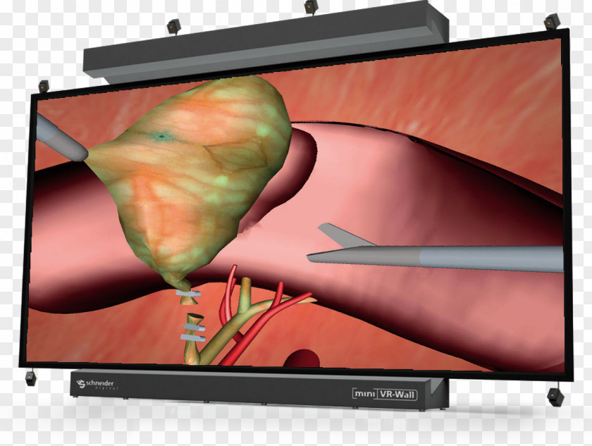 Technology Computer Monitors Virtual Reality Medicine Simulation PNG