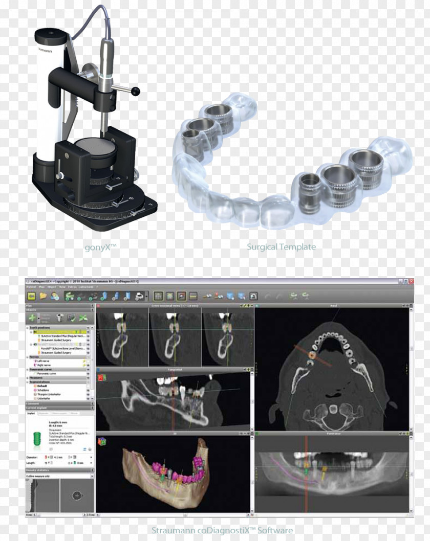 Polymed Chirurgical Inc Dental Implant Straumann Surgery Dentistry PNG