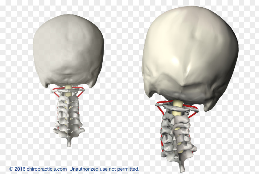 Vertebral Subluxation Column Cervical Vertebrae Chiropractic PNG