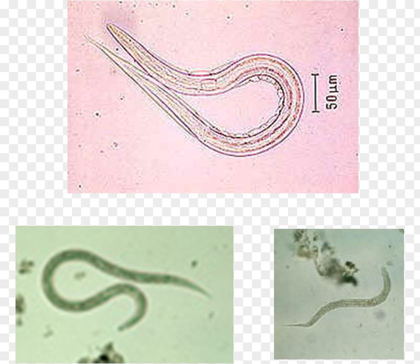 Slip N Slide Ancylostoma Duodenale Hookworm Infection Centers For Disease Control And Prevention Invertebrate Email PNG