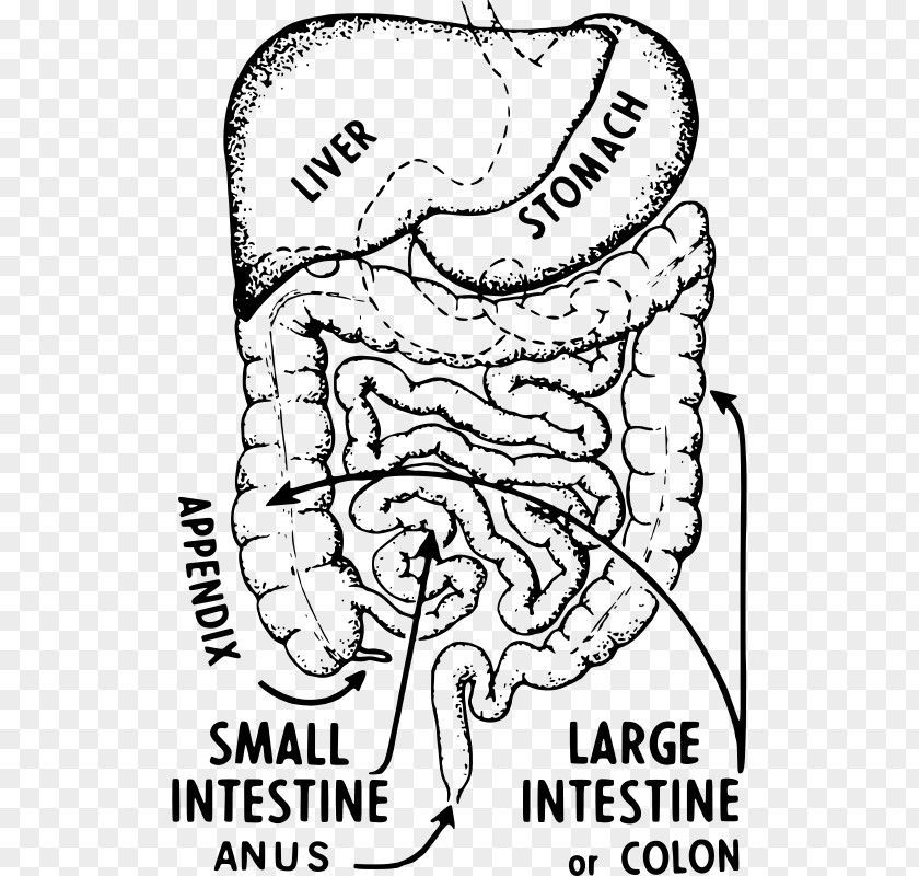 Intestine Appendix Appendicitis Large Symptom Abdominal Pain PNG