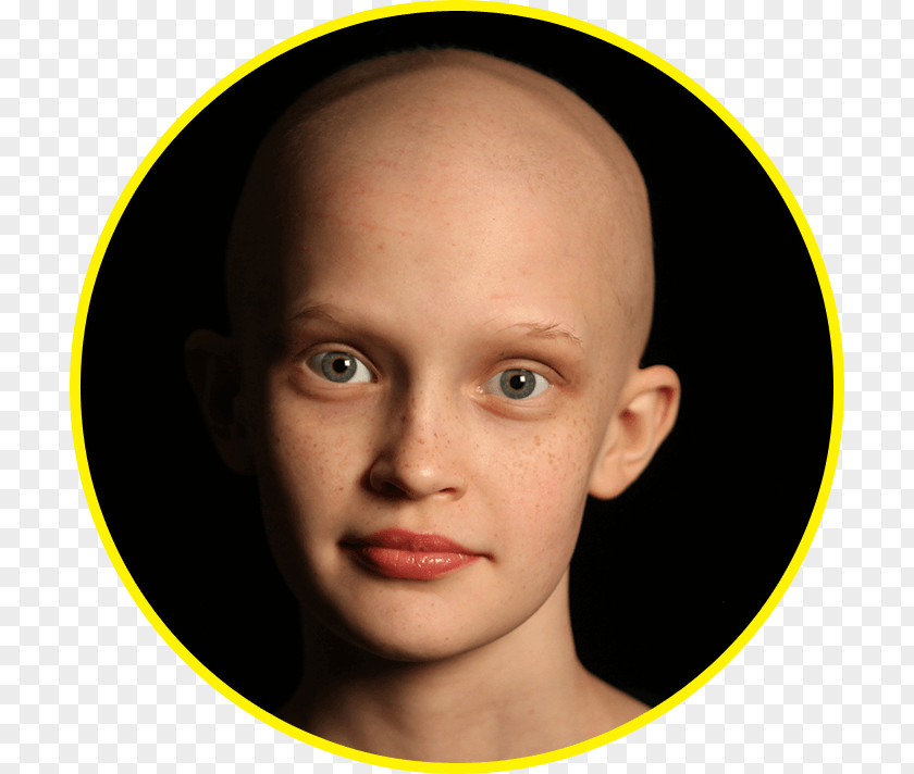 Childhood Cancer Kylie Jenner The Monster Eyebrow PNG