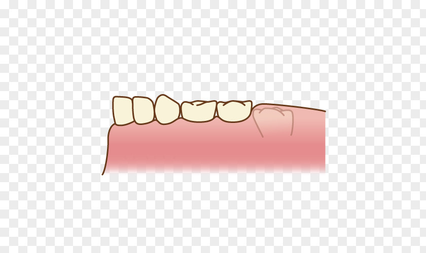Molar Dentistry Poster Human Mouth PNG