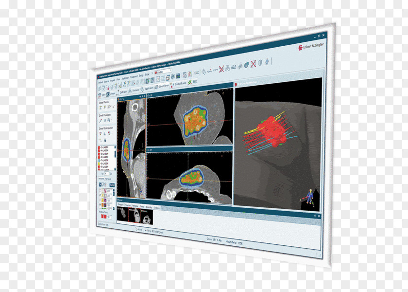 Environmental Labeling Eckert & Ziegler Display Device Brachytherapy Multimedia Radiation Treatment Planning PNG