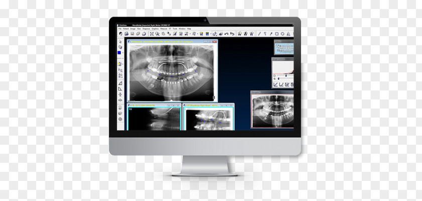 X-ray Machine Computer Software Medical Imaging Radiology Imagerie KaVo Dental GmbH PNG
