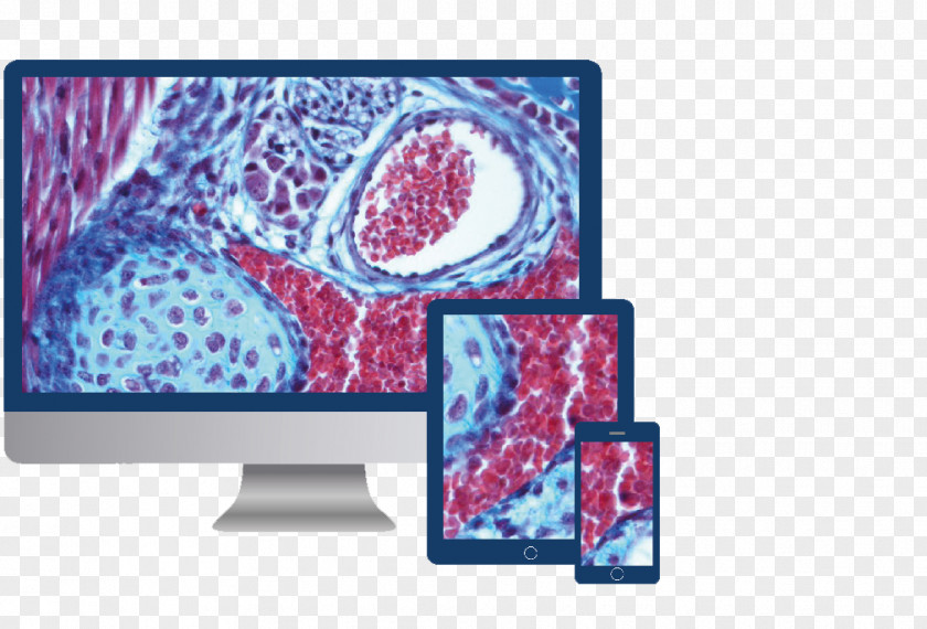 Video Site Acetimo Telepathologie Telemedicine ACETIAM Display Device PNG