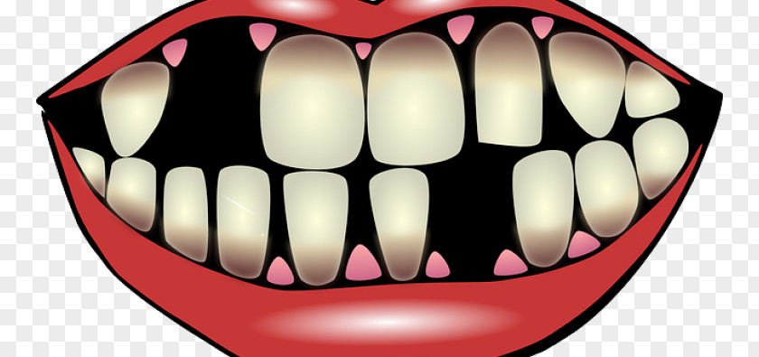 Dental Hygienist Dentistry Implant Tooth PNG