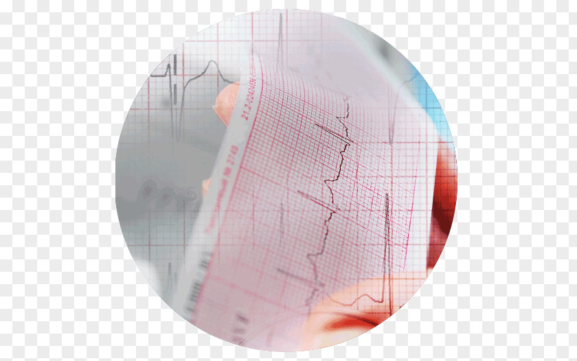 Ecg Interpretation NHS Wales Education Science And Technology National Health Service PNG