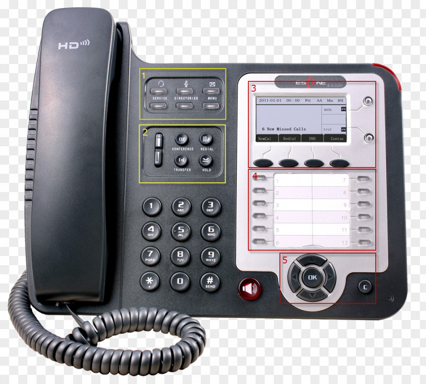 Vocal Cords VoIP Phone Telephone Escene Voice Over IP Power Ethernet PNG