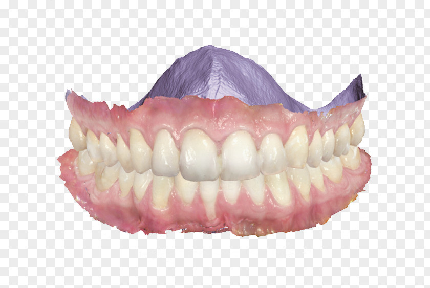 Divider Image Scanner Dentistry 3Shape Patient PNG