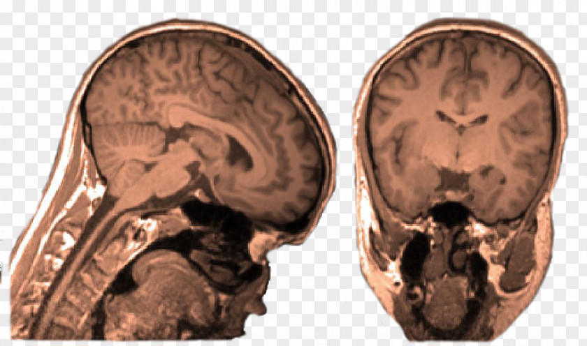 Skull Brain Medicine PNG