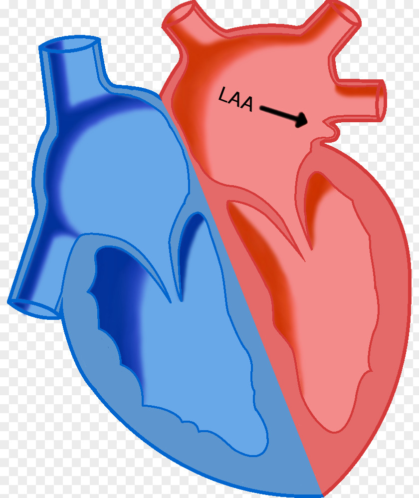 Heart Los Angeles Angels Atrial Septal Defect Atrium Left Appendage PNG