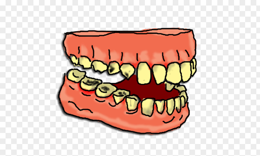 Chickie Cliparts Tooth Decay Pathology Clip Art PNG