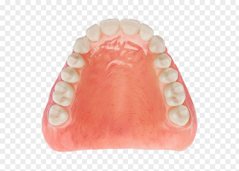 Aspen Dental Tooth Dentures Dentistry Diagnostic Wax-up PNG
