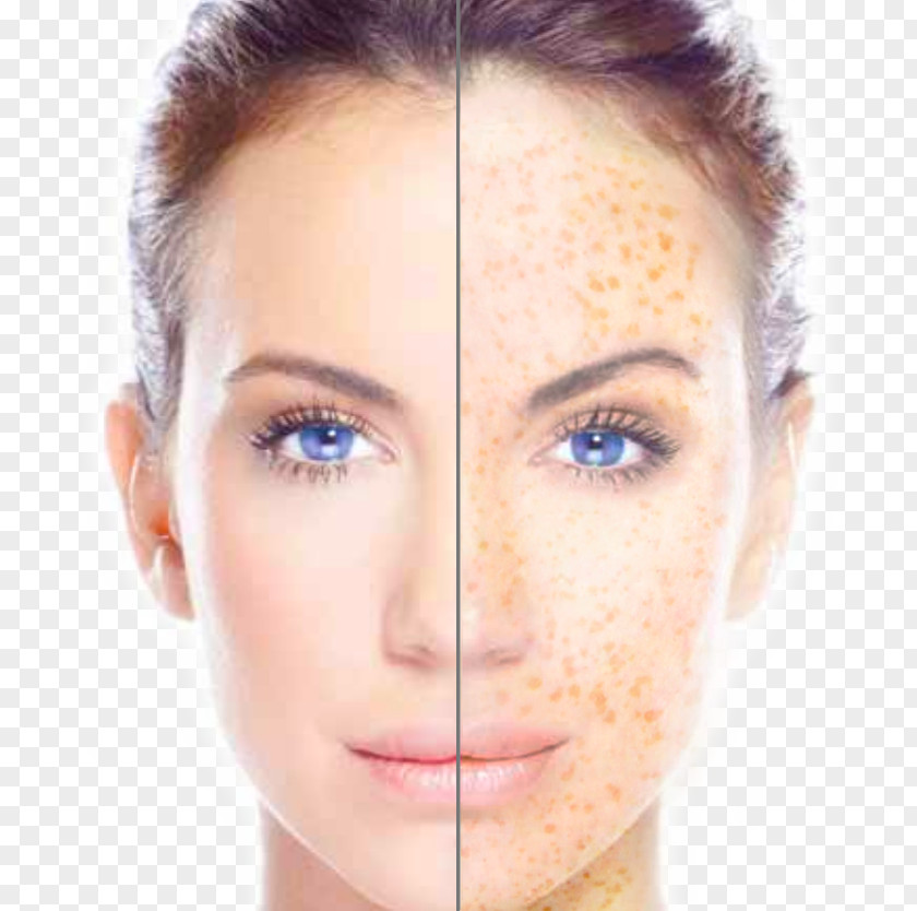 Face Facial Toning Skin Tag PNG