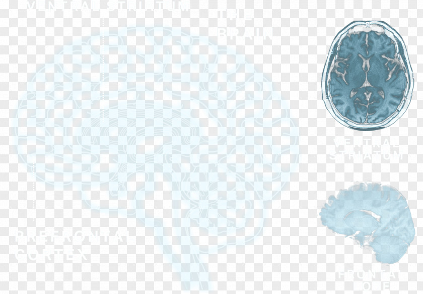 Brain Organism PNG