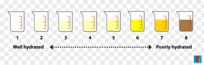 Urine Test Dehydration Diet Kidney Water Retention Diabetes Insipidus PNG