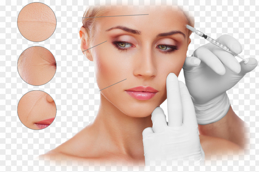 Skin Care Plastic Surgery Wrinkle Botulinum Toxin RG Pro Laser PNG