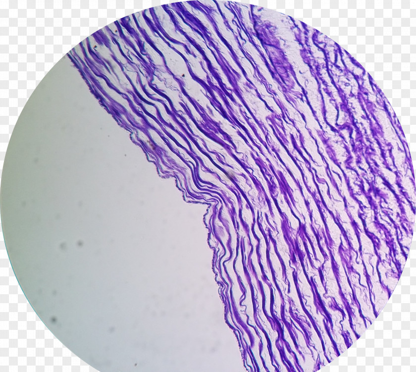 Verse Elastic Fiber Wikimedia Commons Optical Microscope Artery PNG