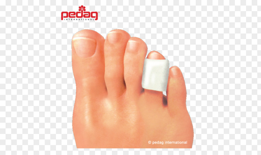 Corn Toe Foot Pain Wart PNG