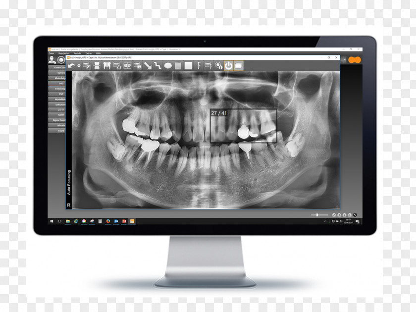 Orange Dentist Computer Monitors Medical Imaging Multimedia Product Design PNG