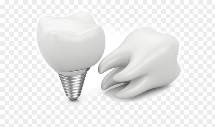 Bridge Dental Implant Dentistry Tooth Dentures PNG