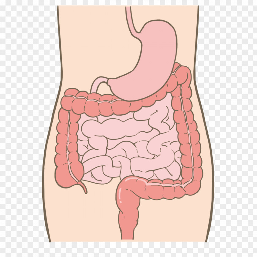 Small Intestine Tokyo Metropolitan Cancer And Infectious Diseases Center Komagome Hospital Colorectal Metastasis PNG