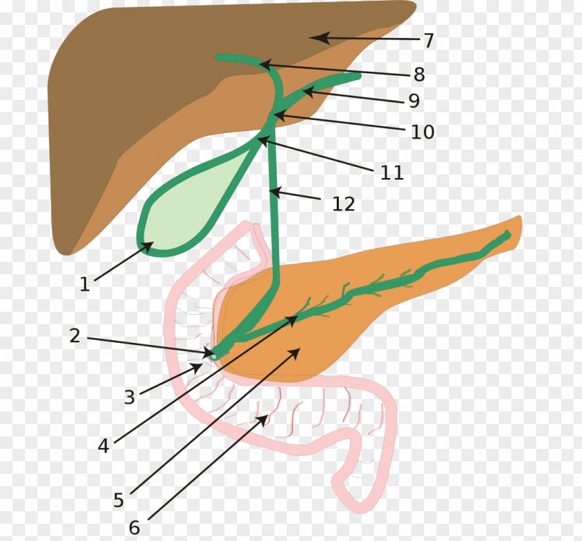 Biliary Atresia Tract Intrahepatic Bile Ducts PNG