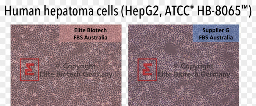 Hep G2 Cell Culture ATCC Biotechnology PNG