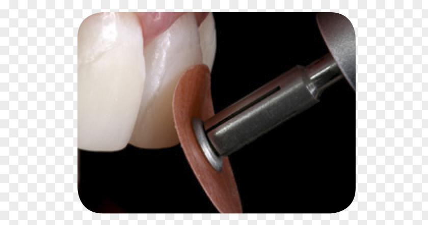 Bad Tooth Nail Polishing Diamond Cutting PNG