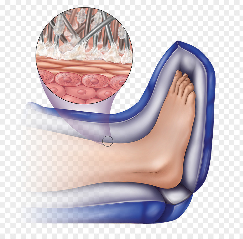 Thumb Heel Foot Drop Common Peroneal Nerve PNG