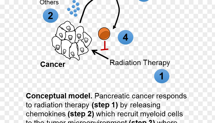 Radiation Therapy Perelman School Of Medicine Oncologist Pancreatic Cancer PNG