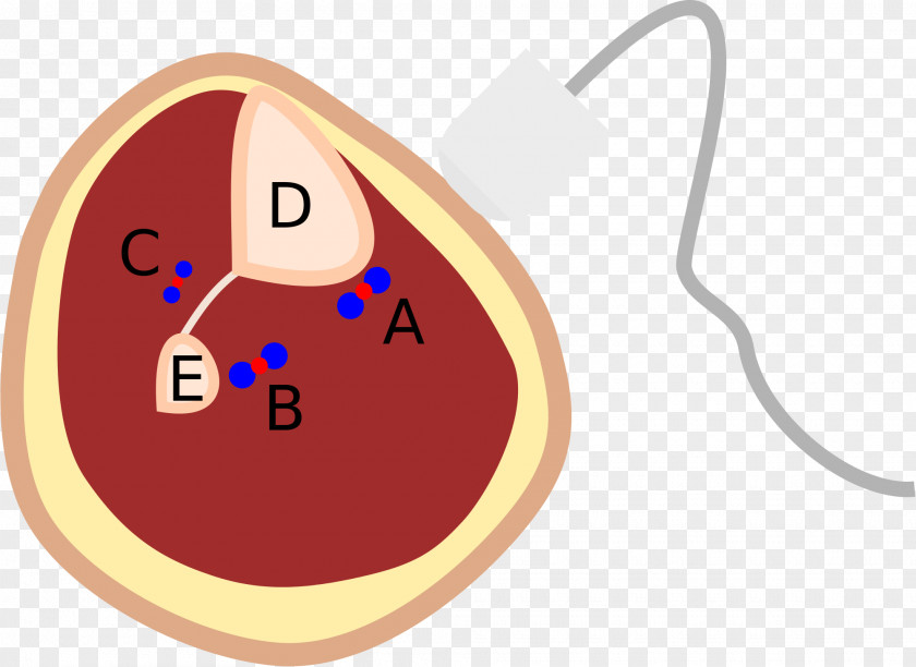 Vein In Kind Calf Posterior Tibial Artery Fibular Anatomy PNG