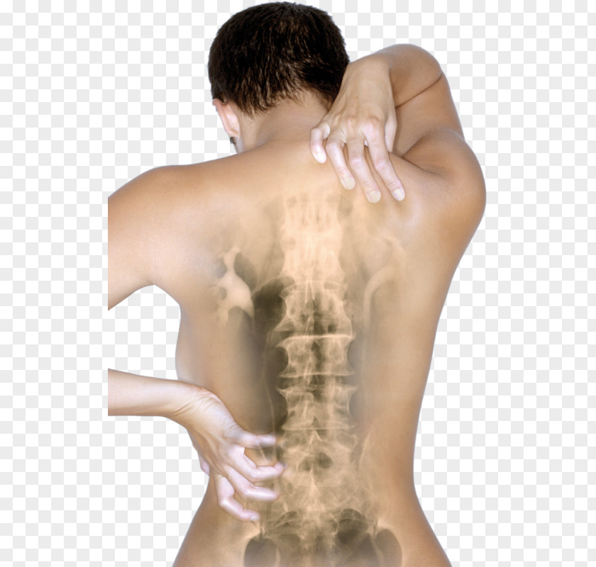 Columna Vertebral Osteochondrosis Column Disease Mugurkaula Osteohondroze Pain PNG