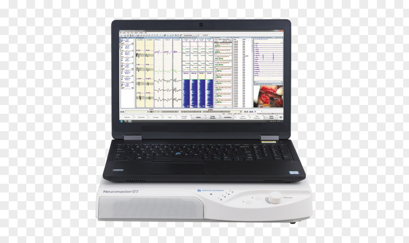 Laptop Netbook Computer Hardware Personal Monitors PNG