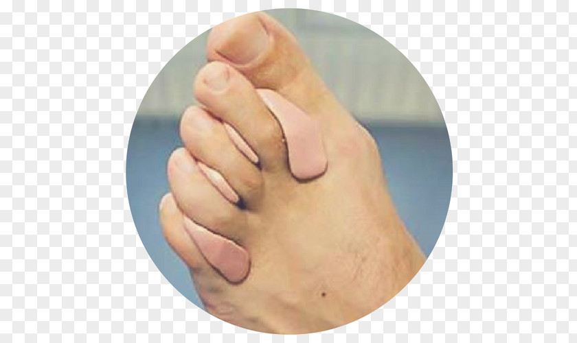 Pedicure Orthotics Hammer Toe Corn Bunion PNG