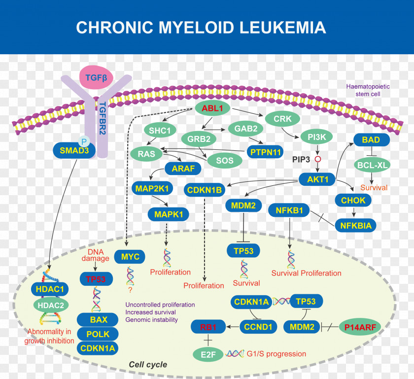 Chronic Myelogenous Leukemia ABL Acute Lymphoblastic Cancer PNG