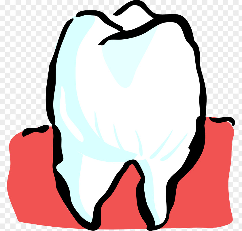 Tooth Decay Human Pediatric Dentistry Clip Art PNG