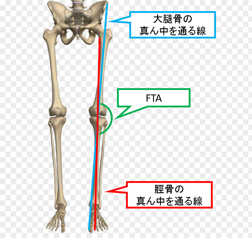 Fta Knee Osteoarthritis Genu Valgum 膝関節 Bone PNG
