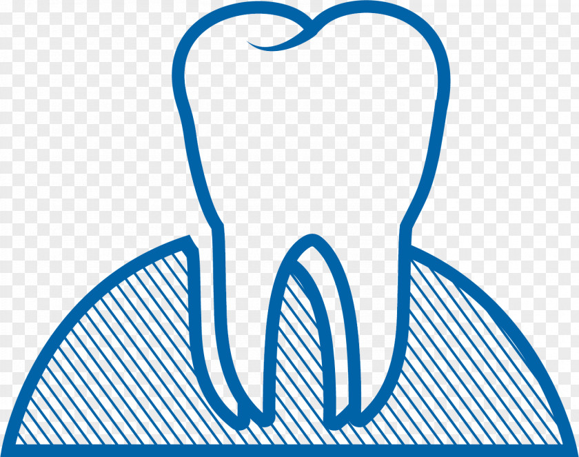 Tooth Extraction Dental Surgery Wisdom Implant PNG