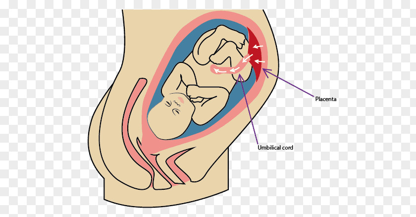 Blood Umbilical Cord Placenta Infant Childbirth PNG